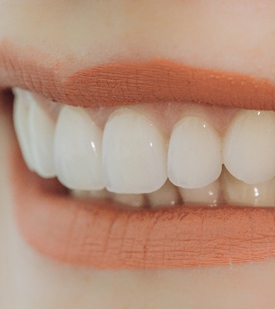 Closeup of smile with dental bridges in Center